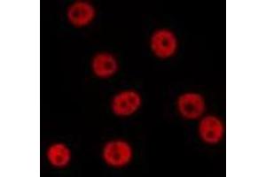 ABIN6278379 staining 293T by IF/ICC. (SSB antibody  (Internal Region))