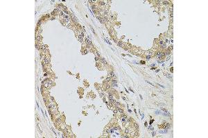 Immunohistochemistry of paraffin-embedded human prostate using KCNJ3 antibody (ABIN6003556) at dilution of 1/100 (40x lens). (KCNJ3 antibody)