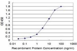 Detection limit for recombinant GST tagged PRKACA is approximately 0. (PRKACA antibody  (AA 1-120))