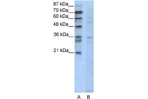 WB Suggested Anti-CCNB3 Antibody Titration:  2. (Cyclin B3 antibody  (N-Term))