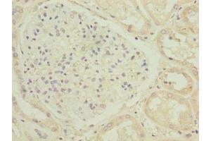 Immunohistochemistry of paraffin-embedded human kidney tissue using ABIN7174751 at dilution of 1:100 (C17ORF47 antibody  (AA 1-300))
