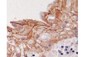 Image no. 1 for anti-Desmoglein 3 (DSG3) antibody (ABIN1721896) (Desmoglein 3 antibody)