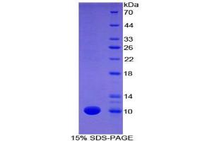 SDS-PAGE analysis of Mouse Fibulin 5 Protein.