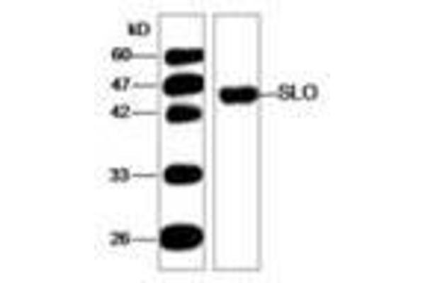Streptolysin O anticorps  (AA 78-206)