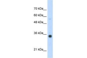 Western Blotting (WB) image for anti-Homeobox B4 (HOXB4) antibody (ABIN2461926)