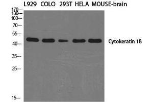 Western Blot (WB) analysis of specific cells using Cytokeratin 18 Polyclonal Antibody. (Cytokeratin 18 antibody  (C-Term))