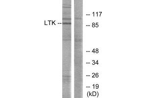 Western Blotting (WB) image for anti-Leukocyte Receptor tyrosine Kinase (LTK) (Internal Region) antibody (ABIN1849300) (LTK antibody  (Internal Region))