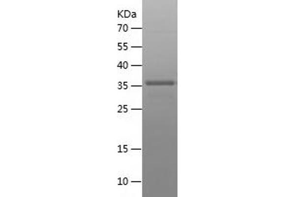 Clusterin Protein (CLU) (AA 184-293) (His-IF2DI Tag)