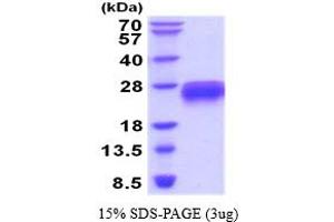 SDS-PAGE (SDS) image for TNF Receptor Superfamily, Member 6 (FAS) (AA 26-173) protein (His tag) (ABIN7540045) (FAS Protein (AA 26-173) (His tag))