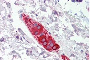 ABIN185737 (5µg/ml) staining of paraffin embedded Human Colon. (FEZ1 antibody  (Internal Region))
