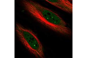 Immunofluorescent staining of human cell line HeLa with CDKN1C polyclonal antibody  at 1-4 ug/mL concentration shows positivity in nucleus but excluded from the nucleoli.