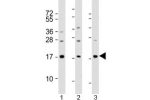 Western blot testing of human 1) A549, 2) HeLa and 3) spleen lysate with PLA2 antibody at 1:2000. (PLA2G1B antibody  (AA 106-135))