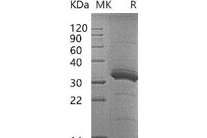 CD3D Protein (Fc Tag)