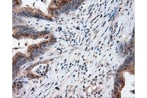 Image no. 2 for anti-Lipase, Endothelial (LIPG) antibody (ABIN1499163) (LIPG antibody)