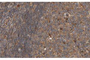 Immunohistochemistry (IHC) image for anti-alpha Tubulin (TUBA1) antibody (ABIN6265801)
