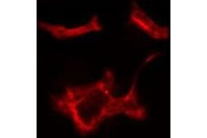 ABIN6279729 staining HeLa cells by IF/ICC. (RAB1B antibody  (Internal Region))