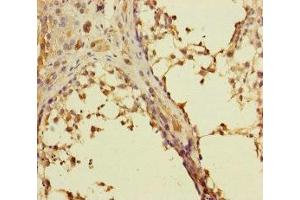 Immunohistochemistry of paraffin-embedded human testis tissue using ABIN7167274 at dilution of 1:100 (RAB27B antibody  (AA 1-218))