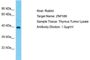 Host: Rabbit Target Name: ZNF586 Sample Type: Thymus Tumor lysates Antibody Dilution: 1.