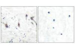 Immunohistochemical analysis of paraffin-embedded human brain tissue using ARC antibody. (ARC antibody)