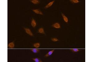 Immunofluorescence analysis of L929 cells using TSG101 Polyclonal Antibody at dilution of 1:100. (TSG101 antibody)