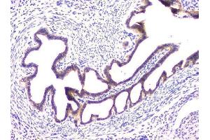 IHC analysis of RAB11B using anti-RAB11B antibody (ABIN6719364). (RAB11B antibody)