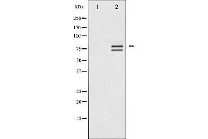 Western blot analysis of Lamin A/C expression in HeLa whole cell lysates,The lane on the left is treated with the antigen-specific peptide. (Lamin A/C antibody  (Internal Region))