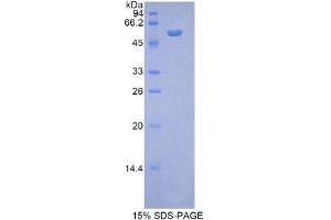 SDS-PAGE (SDS) image for N-Acetyl alpha-D-Glucosaminidase (AA 449-709) protein (His tag,GST tag) (ABIN2123340)