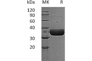 TPSB2 Protein (His tag)