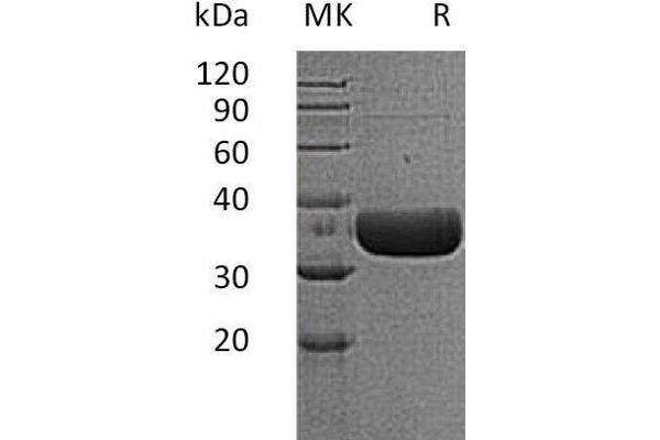TPSB2 Protein (His tag)