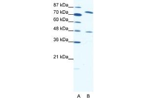 WB Suggested Anti-ZNF225 Antibody Titration:  0.