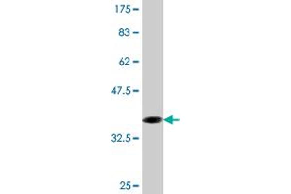 CRYGD antibody  (AA 75-174)