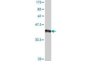 Western Blot detection against Immunogen (37. (LRIG3 antibody  (AA 1020-1119))