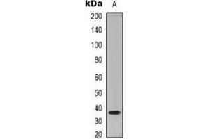 Western blot analysis of TECR expression in HEK293T (A) whole cell lysates.