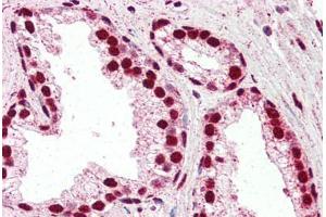 Human Prostate (formalin-fixed, paraffin-embedded) stained with IRF6 antibody ABIN461925 at 2. (IRF6 antibody  (AA 455-467))