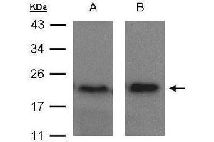 WB Image Sample(30 μg of whole cell lysate) A:MOLT4, B:Raji, 15% SDS PAGE antibody diluted at 1:1500 (ARF5 antibody)