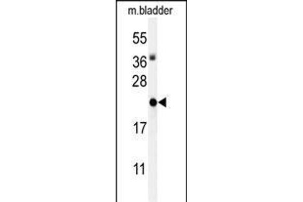 ID4 anticorps  (N-Term)