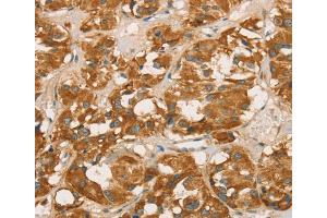 Immunohistochemistry (IHC) image for anti-Retinoblastoma Binding Protein 8 (RBBP8) antibody (ABIN2423210) (Retinoblastoma Binding Protein 8 antibody)