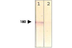 The cell lysate derived from conditioned NIH/3T3 was immunoprobed by LRP6 (phospho T1479) polyclonal antibody  at 1 : 500. (LRP6 antibody  (pThr1479))