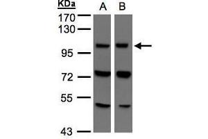 WB Image Sample(30 μg of whole cell lysate) A:293T B:Hep G2, 7. (VPS11 antibody  (Center))