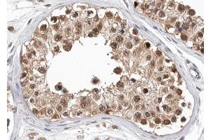 ABIN6268782 at 1/100 staining human testis tissue sections by IHC-P. (PKM antibody  (Internal Region))