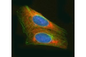 IF analysis of RARS/RARS1 using anti-RARS/RARS1 antibody (ABIN7600223) and anti-Tubulin Alpha antibody (ABIN7600339). (Probable Arginine--tRNA Ligase, Cytoplasmic (RARS-1) (AA 165-425) antibody)