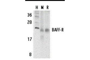 Western Blotting (WB) image for anti-Tumor Necrosis Factor Receptor Superfamily, Member 13C (TNFRSF13C) (C-Term) antibody (ABIN2479576) (TNFRSF13C antibody  (C-Term))