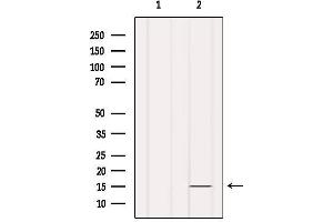 Western blot analysis of extracts from Hela, using INSL5 Antibody. (INSL5 antibody)