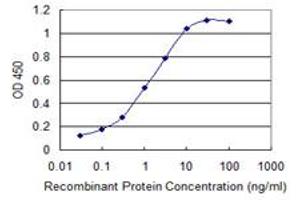 Detection limit for recombinant GST tagged SPINK1 is 0. (SPINK1 antibody  (AA 24-79))