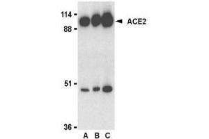 Western blot analysis of ACE2 in human kidney lysate with AP30007PU-N ACE2 antibody at 0.