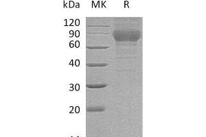 Western Blotting (WB) image for Plexin Domain Containing 2 (PLXDC2) protein (His tag) (ABIN7320630)