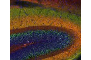 Indirect immunostaining of a PFA fixed mouse hippocampus section with anti-SNAP 25 (dilution 1 : 200; red) and guinea pig anti-VGluT 2 (cat.