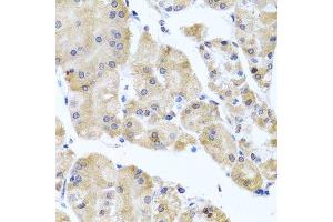 Immunohistochemistry of paraffin-embedded human stomach using CETN3 antibody. (CETN3 antibody  (AA 1-167))