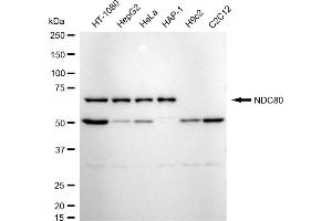 Western blotting analysis using NDC80 antibody (ABIN7799564).