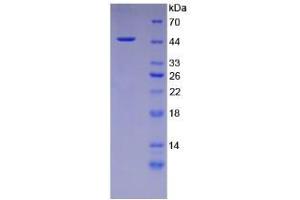 SDS-PAGE analysis of Human Desmoglein 3 Protein. (Desmoglein 3 Protein (DSG3))